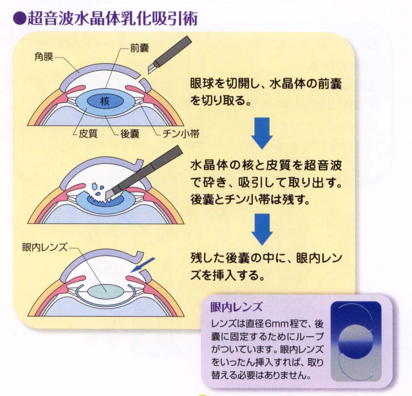 治療は？